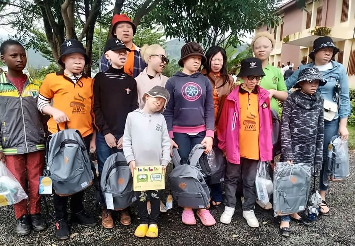 Learners with albinism supported by AWA with their new school bags